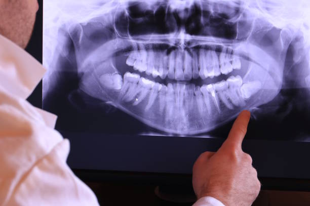 Best Emergency Treatment for Dental Infections or Abscesses in Mayo, MD